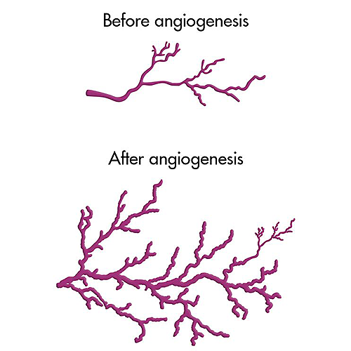 Before and after angiogenesis