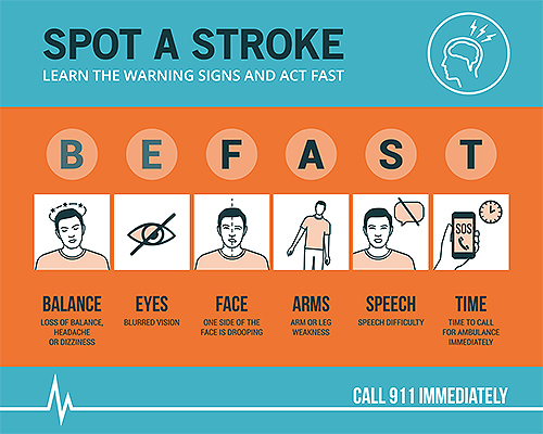 Types Of Stroke Chart
