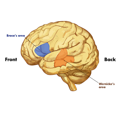 Brain map 